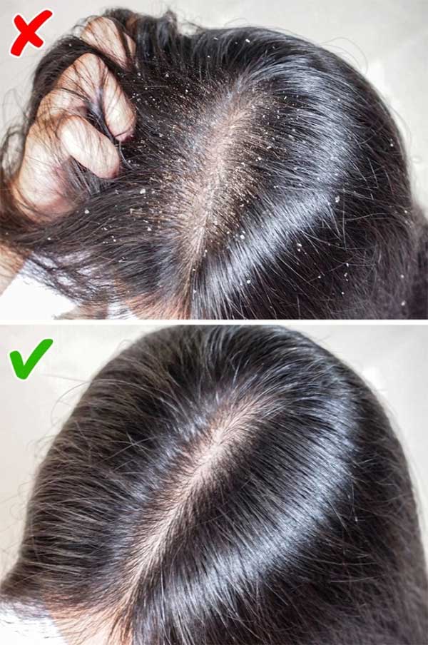 Showering right before bed can leave the scalp and hair damp, leading to various issues