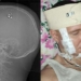 dentist declares brain surgery at home 128770