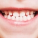 developing a drug that helps teeth erupt multiple times 128718