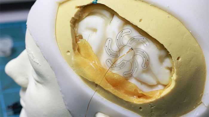 Electrodes placed on a human brain model.