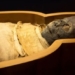 discovery of the body of a child in egypt suffering from anemia 127311
