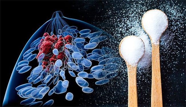 Sugar does not make tumors grow faster.