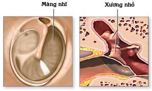eardrumre