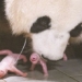 first ever conjoined twins born in south korea 128585