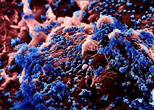 H5N1 (Photo: baggas)