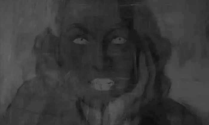 Black and white image from X-ray.