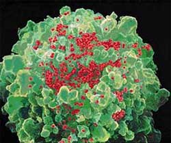 HIV