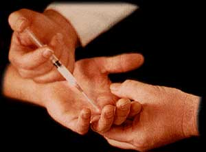 Joint Injection