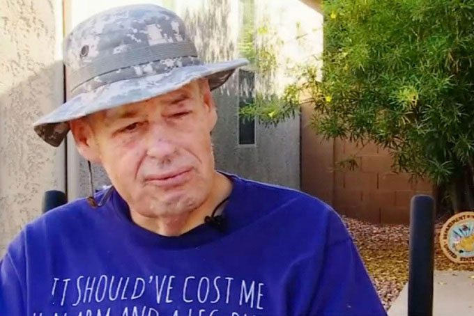 John Fischer, who suffered over 250 bee stings.