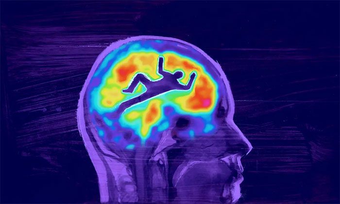 Physical activity is one of the factors related to brain health.