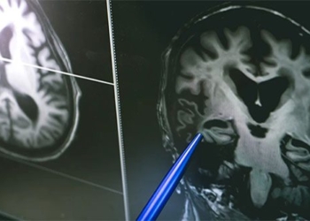 movement through little causes us to age faster 127448