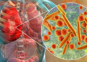 mycoplasma pneumonia causes symptoms and treatment 127626