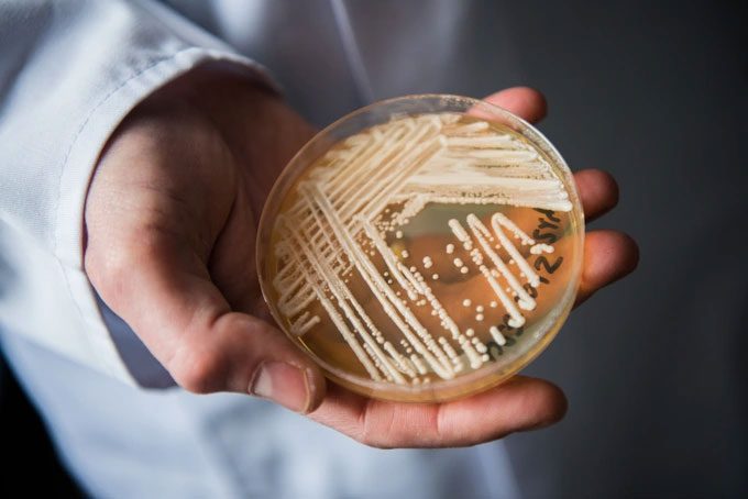 A scientist holding a petri dish containing the deadly fungus Candida auris in a laboratory