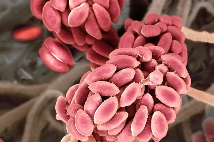 The man was exposed to this fungus while conducting his research