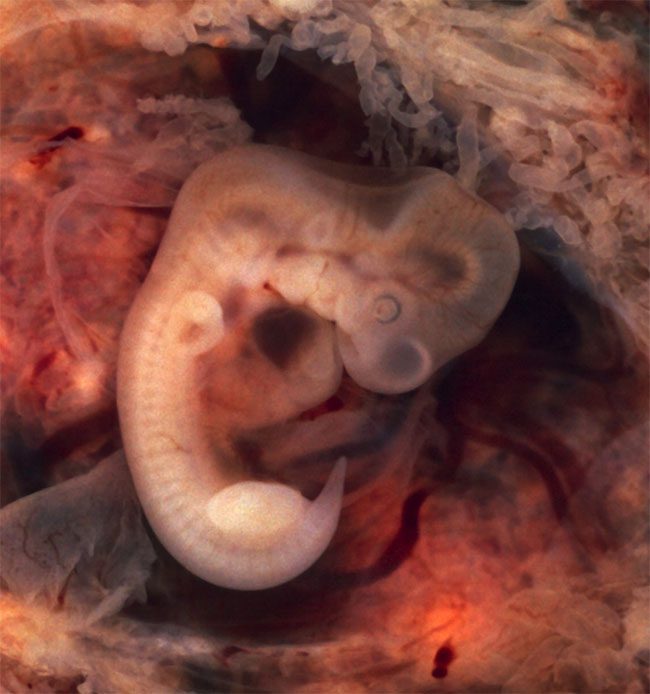 In biology, atavism refers to the modification of biological structures