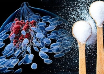 nutrition for cancer patients misconceptions and consequences 127298