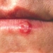 oral injuries in children 5704