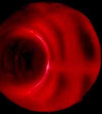 plasma