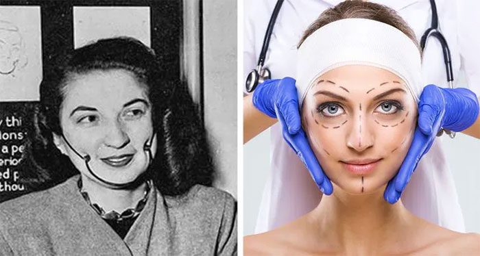 Cosmetic surgery in the 1930s and now
