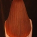 scalp treatment with mesotherapy 5616