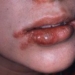 soft tissue injuries in children 5234