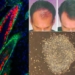 stem cells boost hair growth validated on mice 5713