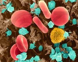 T lymphocyte