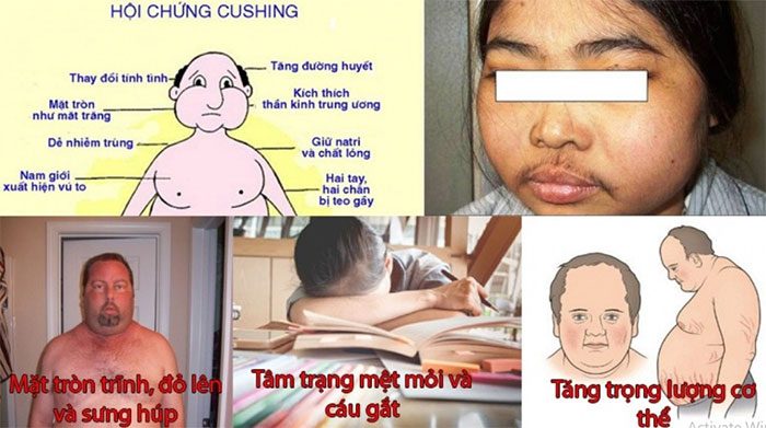 Dangerous side effects caused by corticosteroids