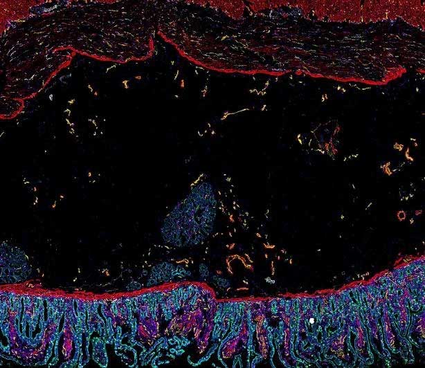 Muscle cells in red surrounded by bright red immune cells