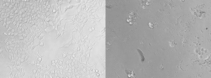 Cultured kidney cells before and after exposure to microplastics