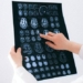 the curious mystery behind the human gene 127281