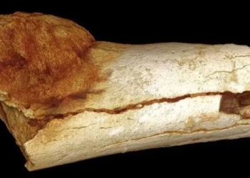 the oldest cancer ever recorded in a person 127368