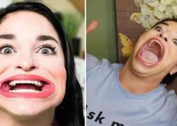 the woman with the largest mouth in the world earns 300 million every time she goes on tiktok 127487