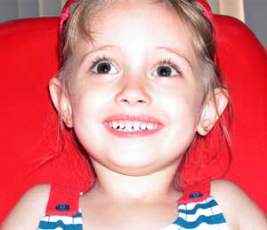 The earlier mutans streptococci appear, the higher the risk of cavities in children
