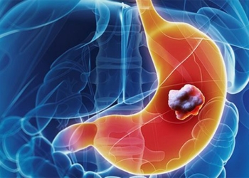top 5 genetic cancer types high risk 127204