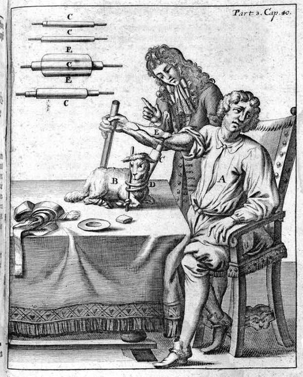 An illustration of milk transfusion from sheep to humans.