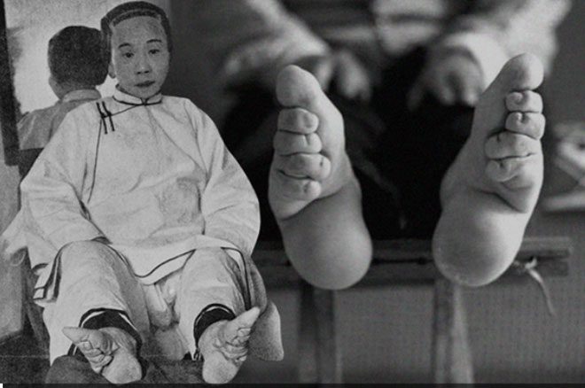 Women in ancient Chinese feudal society believed that foot binding would bring about beautiful three-inch lotus feet.