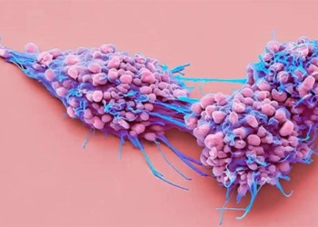 unexpected breakthrough in ovarian cancer treatment 128200