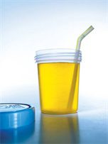 Urine