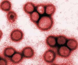 H1N1 Virus