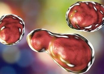 what is brain inflammation due to syphilis 127768