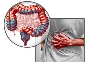 what is intestinal stimulation 127697