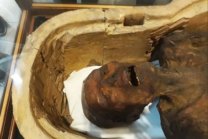 Powder from mummies was used to treat many ailments, including cancer.