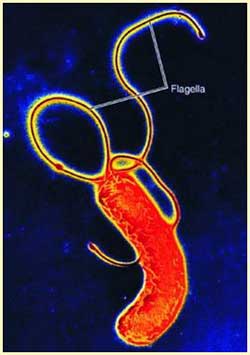 Helicobacter pylori bacteria disturbing the human gastrointestinal tract