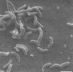 Methanogen (Methanobacterium)