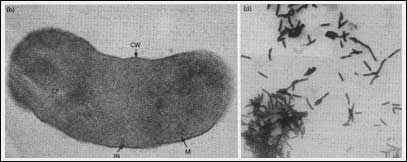 Methanogen (Methanobacterium)