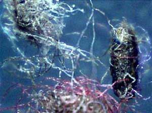 Morgellons fibers