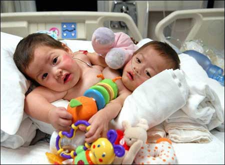Retana and Regina Salinas Fierros before surgery.