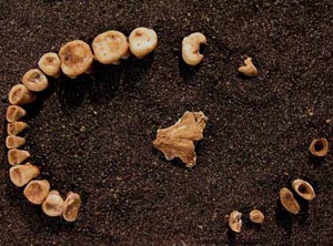 ancient dentures