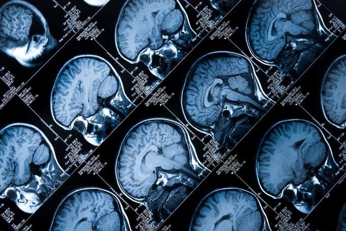 Education makes the biggest difference in cognitive ability